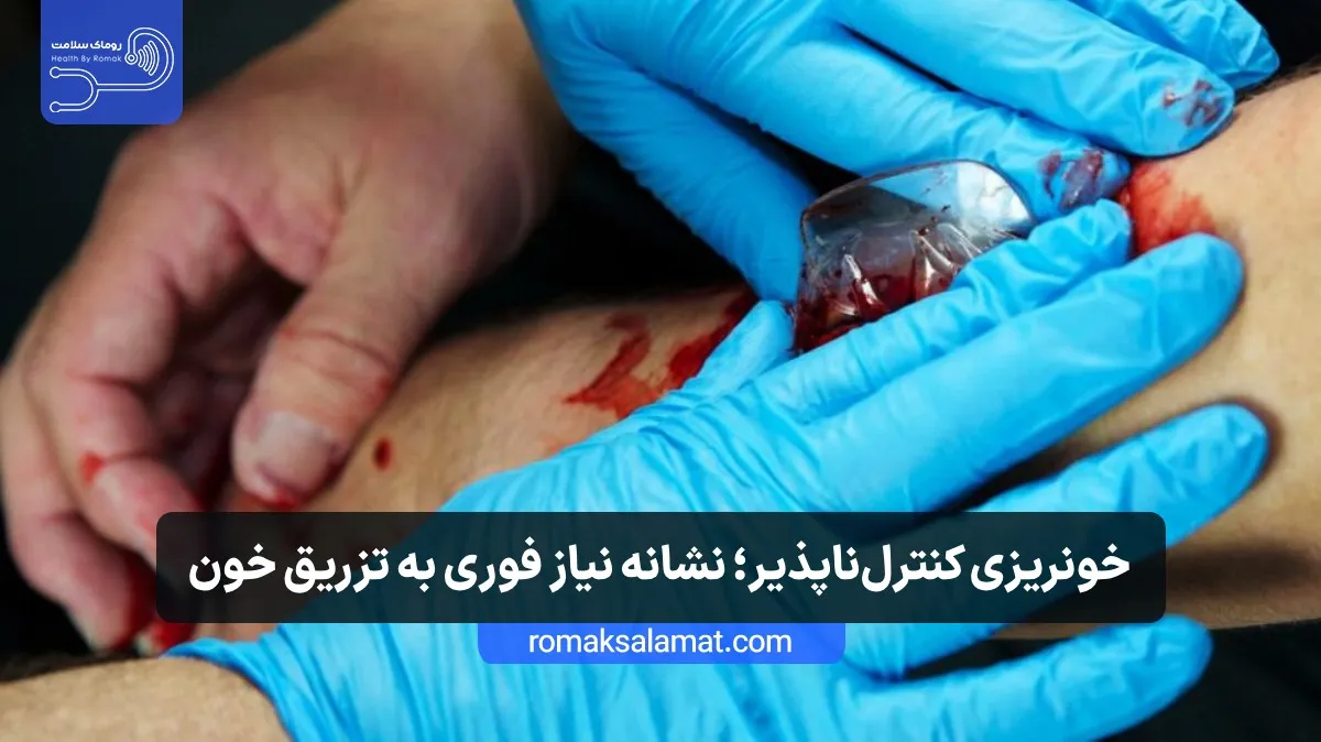 خونریزی کنترلناپذیر
