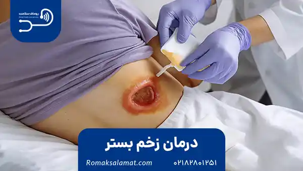 درمان زخم بستر