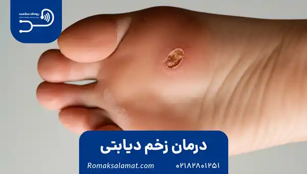 درمان زخم دیابتی